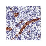 CD31, Endothelial Cell , JC/70A , IgG1 - 1ml