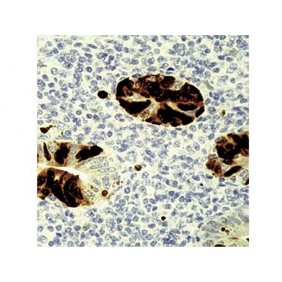 Adenovirus , M58+M73 , IgG2a+IgG2a - 1ml