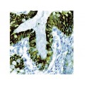 Cytokeratin 8 , 35bH11 , IgM - 1ml