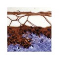 Cytokeratin 10 (56.5 kD) , DE-K10 , IgG1 - 1ml