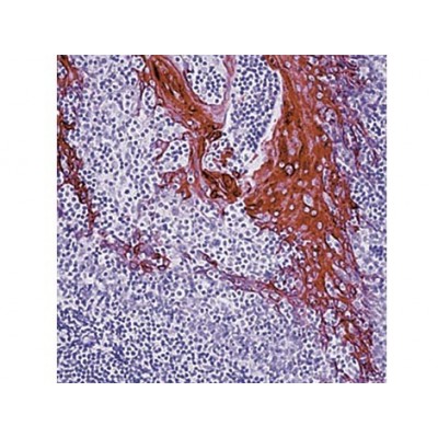 Cytokeratin 10/13 , DE-K13 , IgG2a - 0.5ml