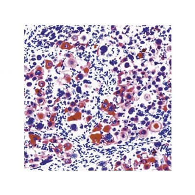 Cytokeratin H.M.W. , 34bE12 , IgG1 - 0.5ml