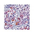 Cytokeratin H.M.W. , 34bE12 , IgG1 - 1ml