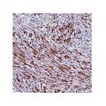 Desmin , D33 , IgG1 - 0.5ml