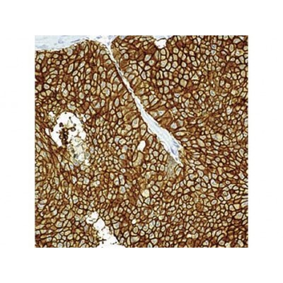 EMA , GP1.4 , IgG1 - 1ml