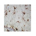 GFAP , GA5 , IgG1 - 1ml