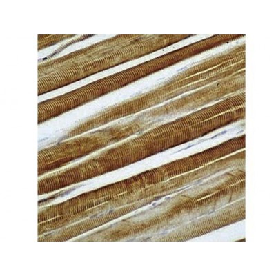 Actin Sarcomeric , 5C5 , IgM - 1ml