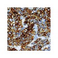 Monoclonal Mouse AntiboCytokeratin 14 , LL002 , IgG3 - 0.5ml