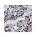 Cytokeratin 18 , DC10 , IgG1 - 0.5ml