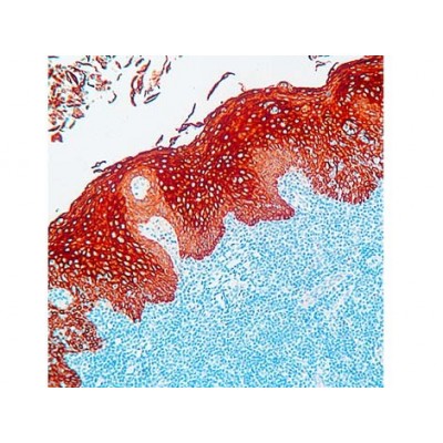 Cytokeratin AE1+AE3 , AE1+AE3 , IgG1 - 0.5ml