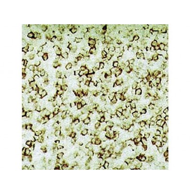 Hairy Cell Leukemia , DBA.44 , IgM - 0.5ml