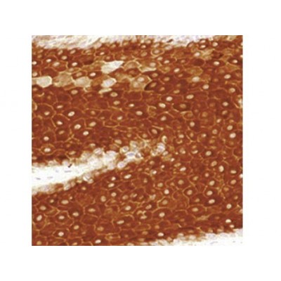Cytokeratin 16 , LL025 , IgG1 - 0.5ml