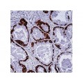 Cytokeratin H.M.W. , DE-SQ , IgG1 - 1ml