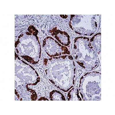 Cytokeratin H.M.W. , DE-SQ , IgG1 - 1ml