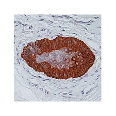 Cytokeratin 15 , LHK15 , IgG2a - 0.5ml