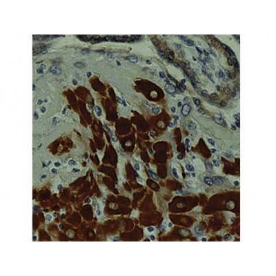 Monoclonal Mouse Antibody toMMP-2 , A-Gel VC2 , IgG1 - 0.5ml