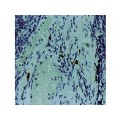 Mast Cell Chymase , CC1 , IgG1 - 1ml