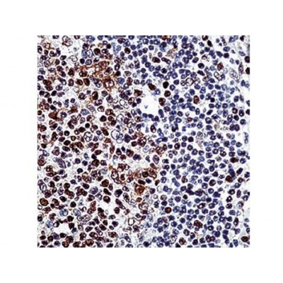 E2F-4 Transcription Factor , 4E2F04 , IgG1 - 1ml