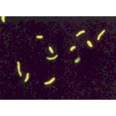 Auramine/Phenol (Lempert) - 1L