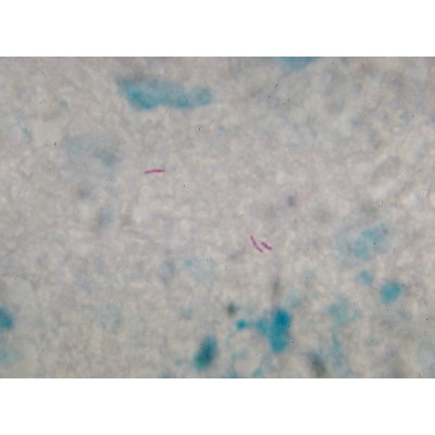 Auramine Permanganate 0.1% Aqueous - 250ML